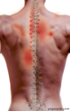 upper back pain